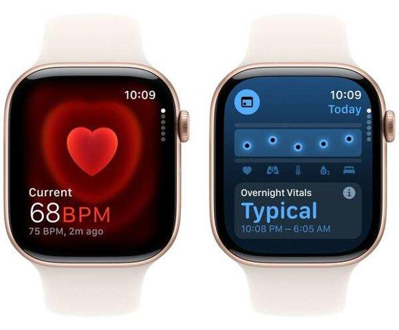 Apple Watch S10 GPS 42mm Rose Gold - slika 4