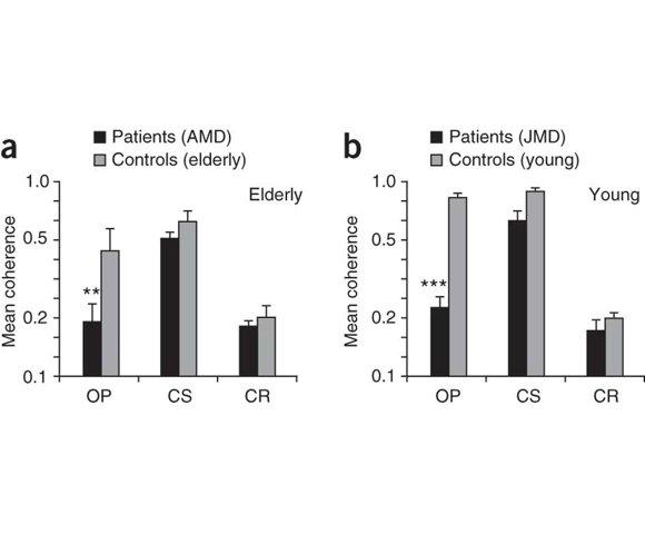 AMD Phenom II X4 965 - slika 3