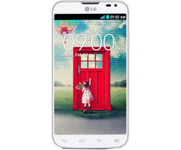 LG L70 - slika 2