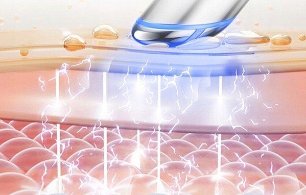 ANLAN 08-AMYY31-02A masažer za lice