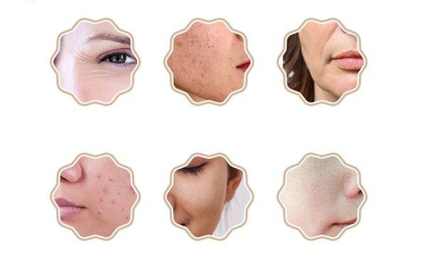 ANLAN 01-AGZMZ21-04E maska za fototerapiju