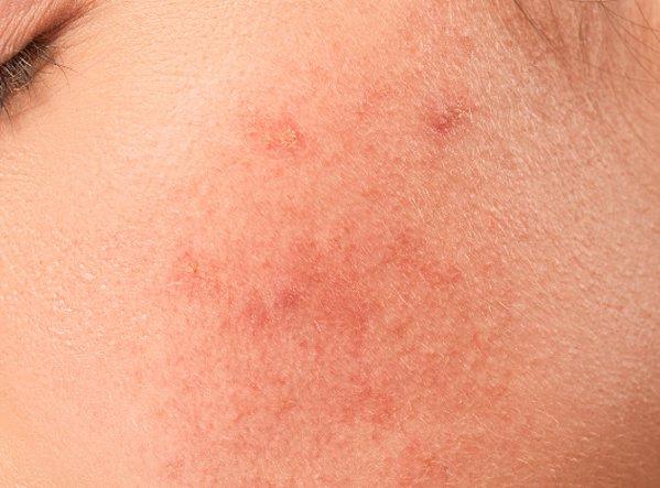 Voden Beauty Filter za umivanje