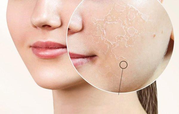 ANLAN 01-AVLY41-02A masažer za lice