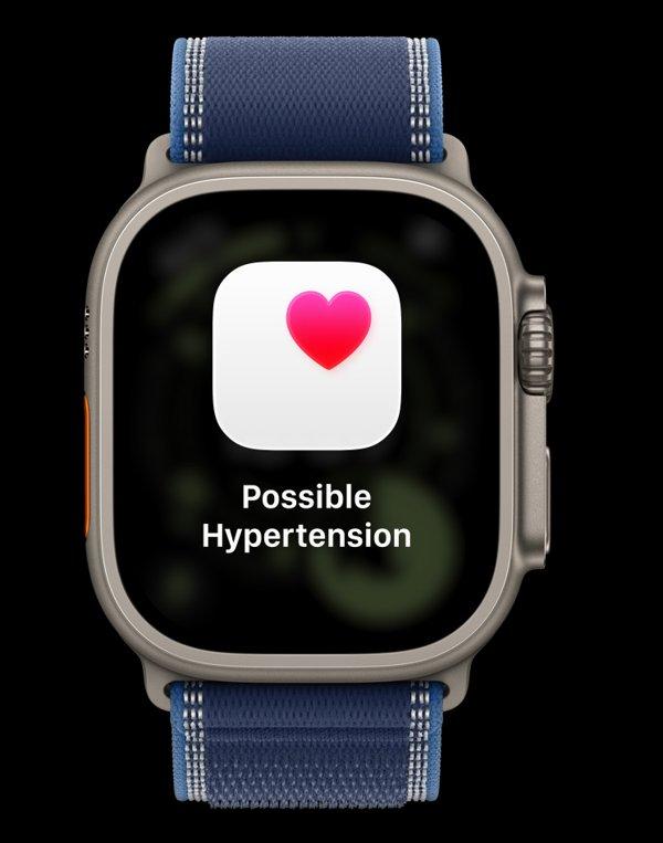 Apple Watch Ultra 3&nbsp;Cellular&nbsp;49mm Natural Titanium (Blue - Bright Blue Trail Loop) - M / L